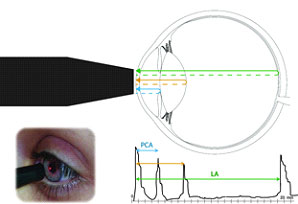 imagem Biometria Ultrassônica